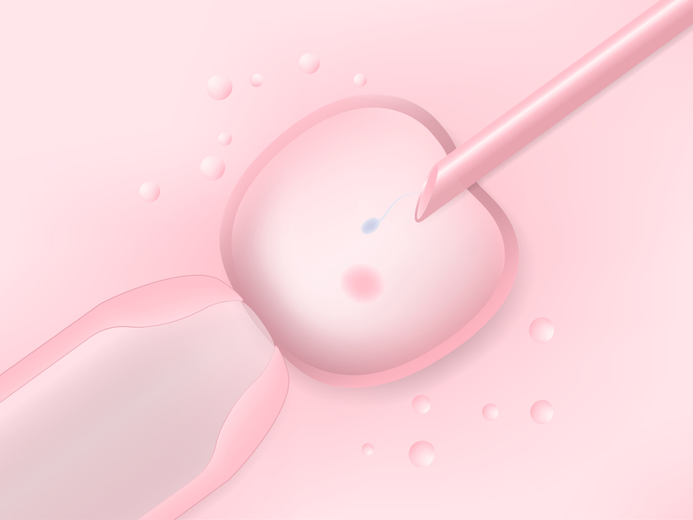 ICSI procedure – single sperm injected into egg at Matrika Advanced Fertility and Laparoscopic Centre, Kondapur, Hyderabad