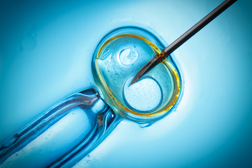 IVF Treatment process illustration – In Vitro Fertilisation at Matrika Advanced Fertility and Laparoscopic Centre, Kondapur, Hyderabad