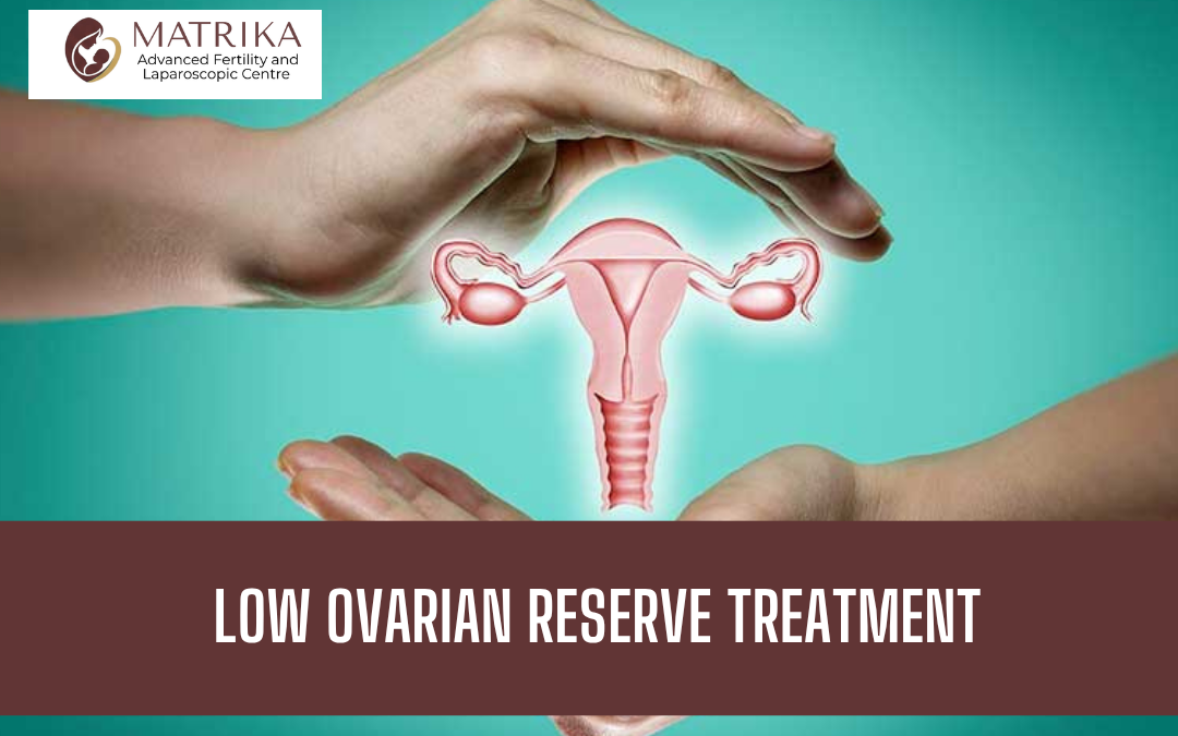 Low Ovarian Reserve Treatment